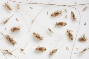 Head Lice Head Lice