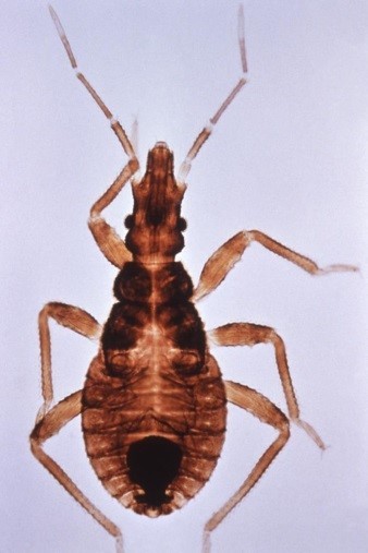 Chagas Chagas