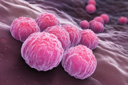 Chlamydia Chlamydia
