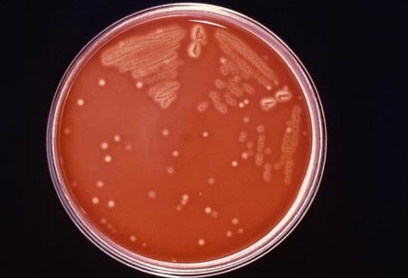 Group A Streptococcal (GAS) Invasive Disease