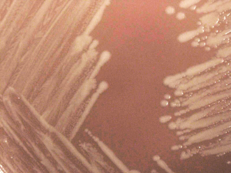 Haemophilus influenzae Invasive Disease Haemophilus influenzae Invasive Disease