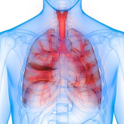 severe-pulmonary-disease-640x640px x-ray image of lungs