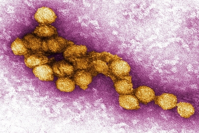 West Nile virus West Nile virus